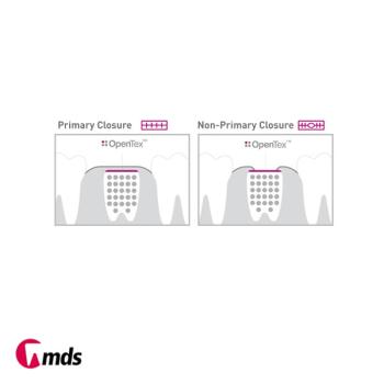 Preview: OpenTex XL   24x30mm