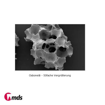 Osbone  1000-2000 µm,  5 x 1,0cc