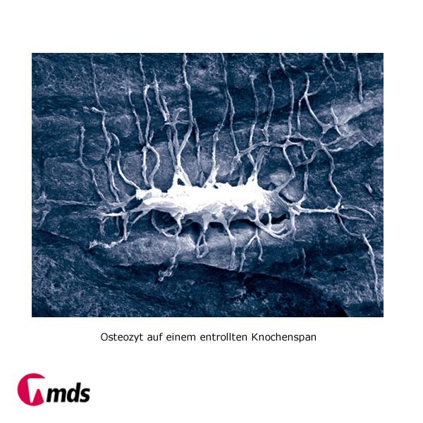 Safescraper Curve   3 Stück